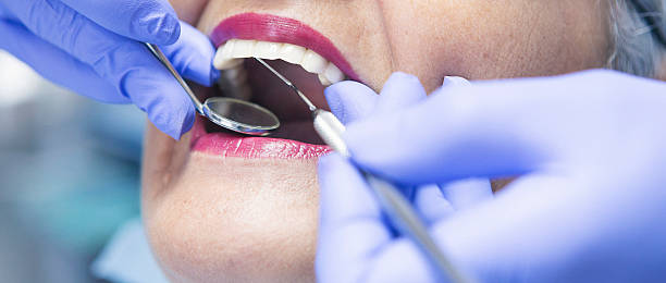Best Dental Abscess Treatment in Bangor, ME